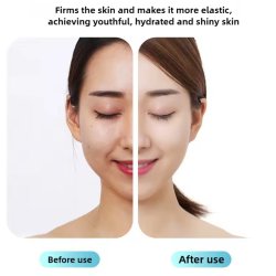 رول یخی جوانسازی و پاکسازی صورت